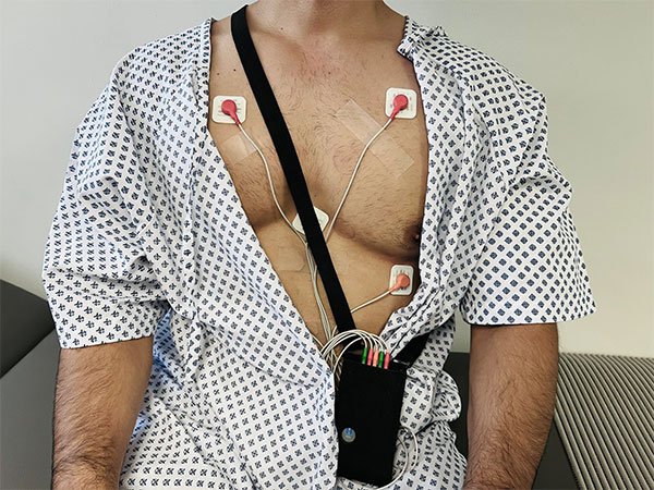 holter 24 y 48 horas